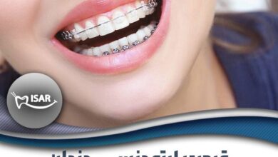 هزینه ارتودنسی دندان چگونه تعیین میشود؟ بررسی عوامل موثر بر هزینه درمان قیمت ارتودنسی